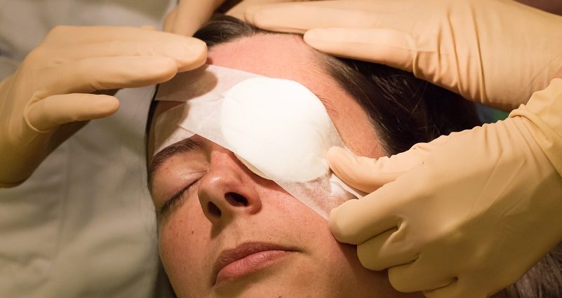 eye surgery